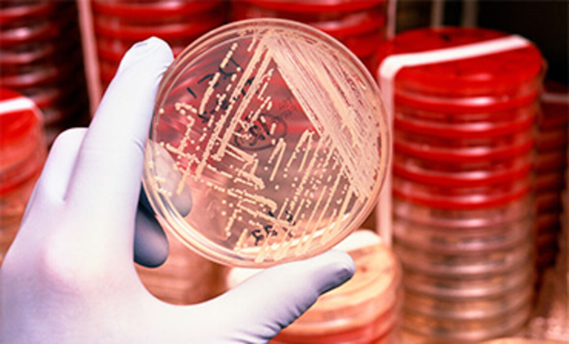 Antibiotic resistant bacteria. © Science Photo Library